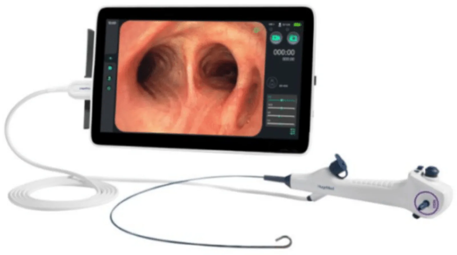 Medical image processor with a touchscreen connected to a video bronchoscope.