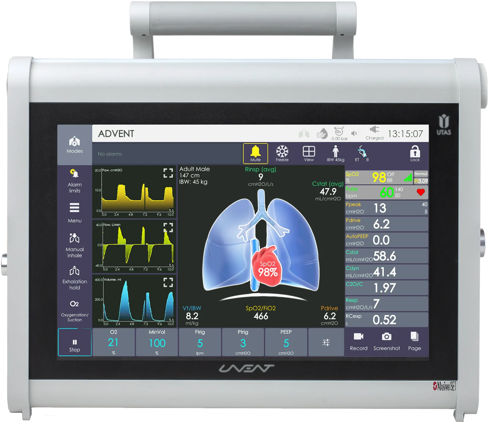 Front view of a UTAS UVENT-S series ventilator with a top handle and a monitoring touchscreen.